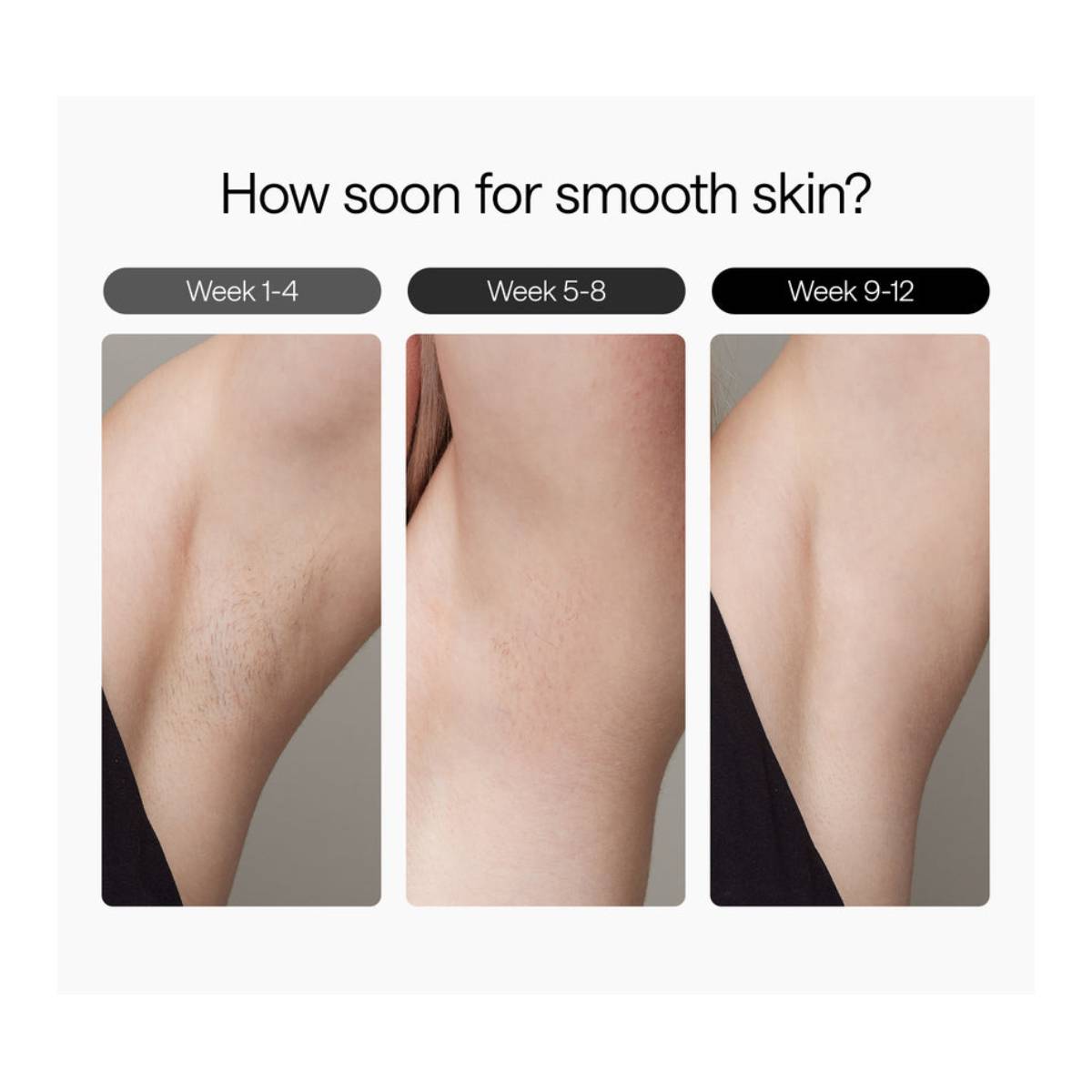 Ulike Air 3 IPL Hair Removal Device with Sapphire Ice Cooling Technology for Face & Body, Lavender | Ulike| Image 2